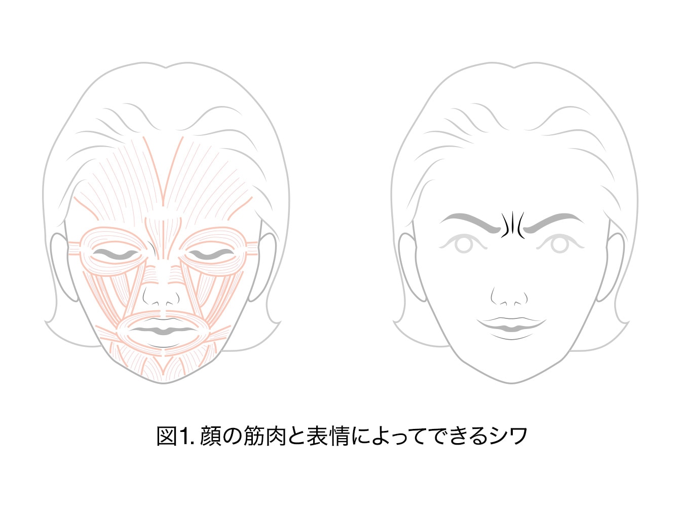 図1.顔の筋肉と表情によってできるシワ